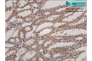 Formalin-fixed and paraffin embedded horse kidney labeled with Anti- HSD11B2 Polyclonal Antibody, Unconjugated at 1:200 followed by conjugation to the secondary antibody and DAB staining (HSD11B2 抗体  (AA 151-250))