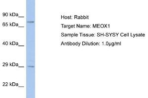 Host: Rabbit Target Name: MEOX1 Sample Tissue: Human SH-SYSY Whole Cell  Antibody Dilution: 1ug/ml (MEOX1 抗体  (C-Term))