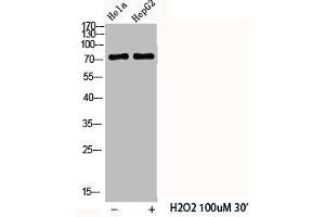 Western Blot analysis of HELA HepG2 cells using Phospho-Cortactin (Y466) Polyclonal Antibody (Cortactin 抗体  (pTyr466))