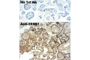 Immunohistochemistry (IHC) image for anti-Epidermal Growth Factor Receptor (EGFR) (C-Term) antibody (ABIN6254171) (EGFR 抗体  (C-Term))