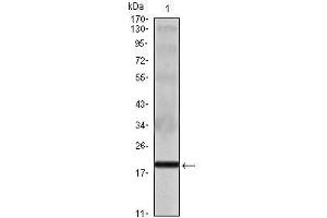 Western Blot showing IL16 antibody used against IL16 recombinant protein. (IL16 抗体)