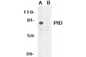 Image no. 1 for anti-Metastasis Associated 1 Family, Member 2 (MTA2) (AA 652-668) antibody (ABIN265128) (MTA2 抗体  (AA 652-668))
