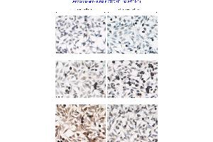 Image no. 3 for anti-F-Box Protein 11 (FBXO11) (Internal Region) antibody (ABIN559708) (FBXO11 抗体  (Internal Region))