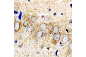 Immunohistochemistry (IHC) image for anti-Ribosomal Protein, Large, p1 (RPLP1) antibody (ABIN7308288) (RPLP1 抗体)