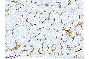 Immunohistochemistry (IHC) image for anti-CD34 (CD34) (AA 33-290) antibody (ABIN7453960)