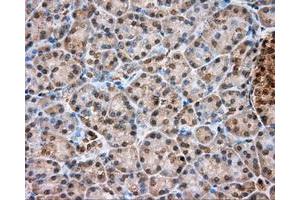 Immunohistochemical staining of paraffin-embedded liver tissue using anti-TPMT mouse monoclonal antibody. (TPMT 抗体)