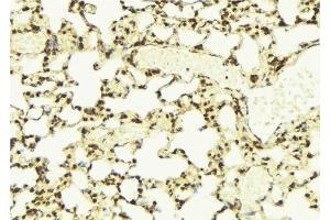 ABIN6275531 at 1/100 staining Mouse lung tissue by IHC-P. (NEK7 抗体  (Internal Region))