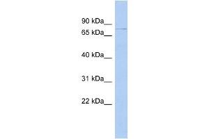 DHX58 antibody used at 1 ug/ml to detect target protein. (DHX58 抗体)
