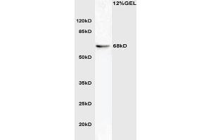 L1 mouse brain lysate probed with Anti phospho-ATG16A(Ser287) Polyclonal Antibody, Unconjugated  at 1:3000 for 90 min at 37˚C.