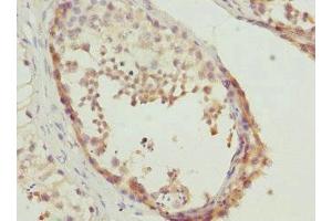 Immunohistochemistry of paraffin-embedded human testis tissue using ABIN7150790 at dilution of 1:100 (TESK2 抗体  (AA 302-571))