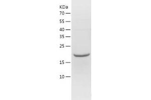 Western Blotting (WB) image for Regulator of G-Protein Signaling 16 (RGS16) (AA 1-202) protein (His tag) (ABIN7124815) (RGS16 Protein (AA 1-202) (His tag))