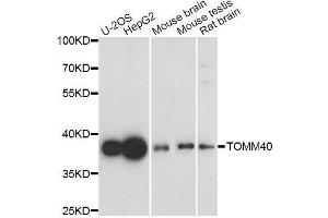 Western blot analysis of extracts of various cell lines, using TOMM40 antibody. (TOMM40 抗体  (AA 1-90))