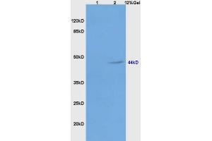 Lane 1: mouse liver lysates Lane 2: human colon carcinoma lysates probed with Anti Galactosidase alpha Polyclonal Antibody, Unconjugated (ABIN872875) at 1:200 in 4 °C. (GLA 抗体  (AA 101-200))