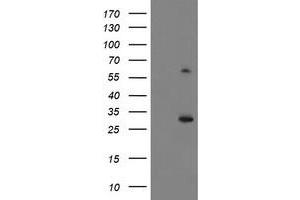 Western Blotting (WB) image for anti-Potassium Channel Tetramerisation Domain Containing 14 (KCTD14) antibody (ABIN1499009) (KCTD14 抗体)