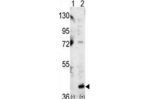 Western Blotting (WB) image for anti-Mitogen-Activated Protein Kinase 14 (MAPK14) antibody (ABIN3003280) (MAPK14 抗体)