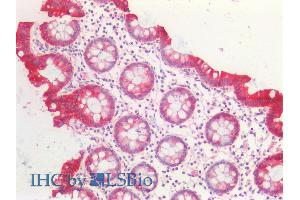 ABIN5539706 (5µg/ml) staining of paraffin embedded Human Colon. (KRT20 抗体  (Internal Region))