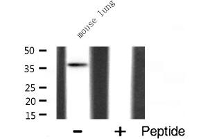 Western blot analysis of hnRNP A2/B1 expression in Mouse lung lysate (HNRNPA2B1 抗体  (N-Term))