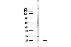 anti-Inhibitor of DNA Binding 2 (Id2) (C-Term) antibody