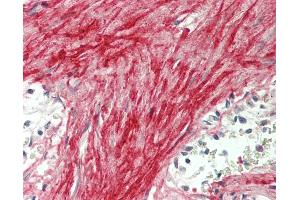 Human Spleen, Trabecula: Formalin-Fixed, Paraffin-Embedded (FFPE)