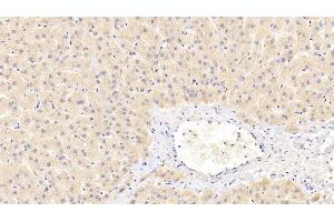 Detection of PEX2 in Human Liver Tissue using Polyclonal Antibody to Peroxisomal Biogenesis Factor 2 (PEX2) (PEX2 抗体  (AA 233-305))
