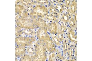 Immunohistochemistry of paraffin-embedded mouse kidney using XIAP antibody (ABIN5974139) at dilution of 1/100 (40x lens). (XIAP 抗体)