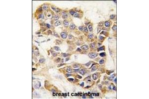 Immunohistochemistry (Paraffin-embedded Sections) (IHC (p)) image for anti-Matrix Metallopeptidase 9 (Gelatinase B, 92kDa Gelatinase, 92kDa Type IV Collagenase) (MMP9) (AA 644-673), (C-Term) antibody (ABIN390154)