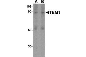 Western blot analysis of TEM1 in human colon tissue lysate with this product at (A) 0. (CD248 抗体  (N-Term))