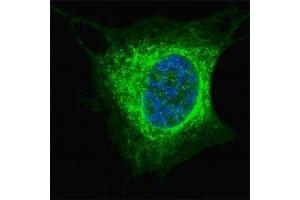 Fluorescent confocal image of SY5Y cells stained with Vimentin antibody at 1:200. (Vimentin 抗体  (AA 63-90))