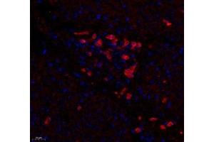 Immunofluorescence (Paraffin-embedded Sections) (IF (p)) image for anti-Tumor Necrosis Factor Receptor Superfamily, Member 6b, Decoy (TNFRSF6B) antibody (ABIN7076071)