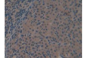 DAB staining on IHC-P; Samples: Mouse Ovary Tissue (Galectin 6 抗体  (AA 1-301))