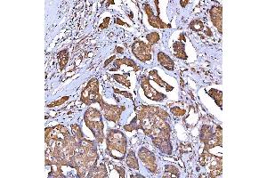 IHC analysis of TOMM34 using anti-TOMM34 antibody (ABIN7599253).