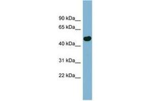 Image no. 1 for anti-EF-Hand Calcium Binding Domain 4B (EFCAB4B) (AA 71-120) antibody (ABIN6741790)