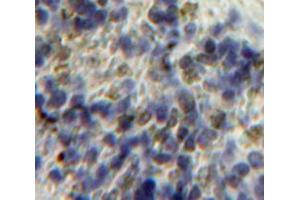 Used in DAB staining on fromalin fixed paraffin-embedded Spleen tissue (HPSE 抗体  (AA 34-115))