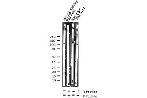 Western Blotting (WB) image for anti-Phospholipase A2, Group IVA (Cytosolic, Calcium-Dependent) (PLA2G4A) (pSer505) antibody (ABIN6255383)