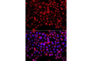 Immunofluorescence analysis of  cells using SULT1E1 antibody (ABIN6129758, ABIN6148714, ABIN6148715 and ABIN6223332). (SULT1E1 抗体  (AA 140-294))