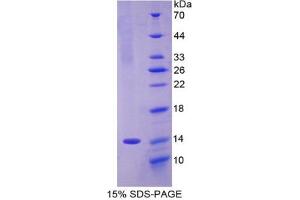 SDS-PAGE analysis of Rat Olfactomedin 4 Protein. (Olfactomedin 4 Protein (OLFM4))