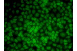 Immunofluorescence analysis of HeLa cells using UMPS antibody. (UMPS 抗体)