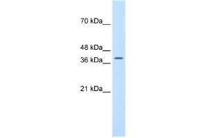WB Suggested Anti-TFB2M Antibody Titration:  1. (TFB2M 抗体  (N-Term))