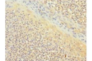 Immunohistochemistry of paraffin-embedded human tonsil tissue using ABIN7171372 at dilution of 1:100 (CD1c 抗体  (AA 18-300))