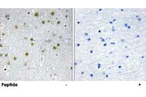 Immunohistochemistry analysis of paraffin-embedded human brain tissue, using NRIP2 polyclonal antibody . (NRIP2 抗体  (N-Term))