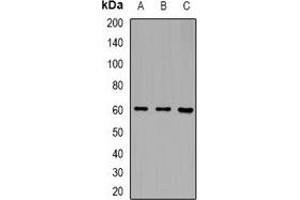 Western blot analysis of CD85c expression in MCF7 (A), mouse blood (B), rat blood (C) whole cell lysates.
