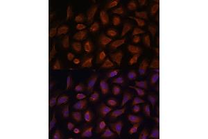 Immunofluorescence (IF) image for anti-Thymic Stromal Lymphopoietin (TSLP) (AA 29-159) antibody (ABIN6149624)