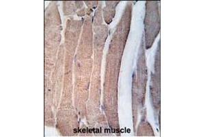 Formalin-fixed and paraffin-embedded human skeletal muscle tissue reacted with DK2 Antibody (N-term V55) 7218a , which was peroxidase-conjugated to the secondary antibody, followed by DAB staining. (DAPK2 抗体  (N-Term))