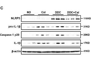 Calcipotriol supplement inhibits the NLRP3 inflammasome activation during DDC-induced and BDL-induced cholestatic liver injury.
