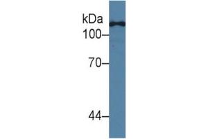 Mouse Capture antibody from the kit in WB with Positive Control:  Human Hela Cells.