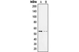 Western blot analysis of KLF11 expression in Jurkat (A), HL60 (B) whole cell lysates.