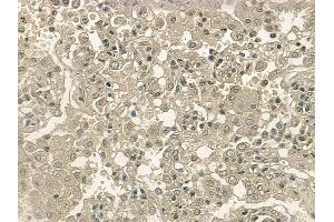 ABIN6255875 and ABIN6267214 at 1/100 staining human normal lung tissue by IHC-P.