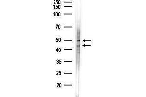 Western blot analysis of lysates from LoVo cells(heat-shock,45 min treatment), using FOX1 Antibody at 1/1000 dilution.