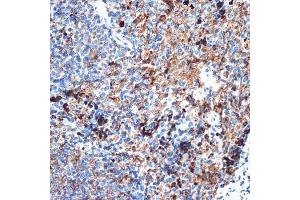 Immunohistochemistry of paraffin-embedded rat spleen using CRMP5/DPYSL5 Rabbit mAb (ABIN7266774) at dilution of 1:100 (40x lens). (DPYSL5 抗体)