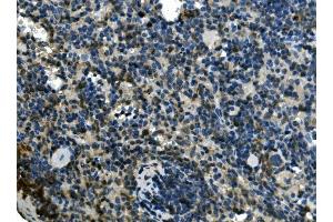 IHC analysis of EIF4A1 using anti-EIF4A1 antibody (ABIN7603125).